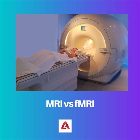 MRI vs fMRI: Difference and Comparison