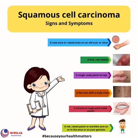 Squamous Cell Carcinoma: Signs & Symptoms