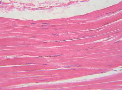 Skeletal Muscle Histology Skeletal Muscle Histology Slide 1824 | The ...