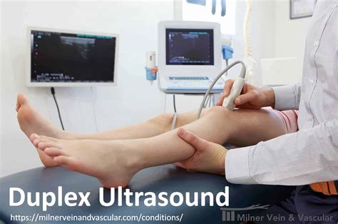 Duplex Ultrasound in Lithonia, GA 30058 | Dosula