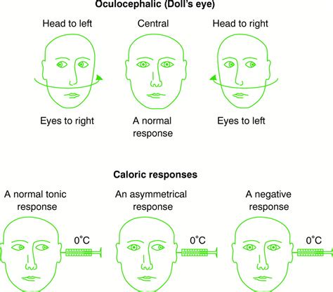 Viee: Doll Eyes Fenomena