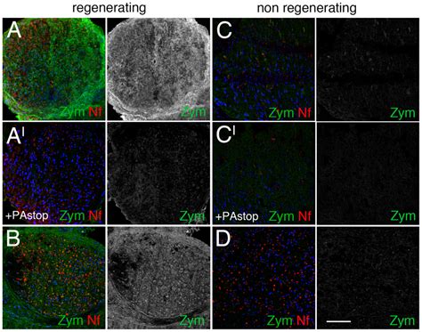 Fibrinolytic activity in human neuropathies. In situ zymography in ...