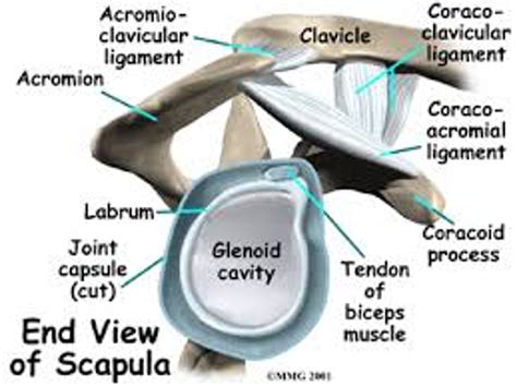 Solved Here is an illustration of the glenoid labrum. 1. | Chegg.com