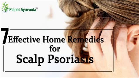 7 Effective Home Remedies for Scalp Psoriasis