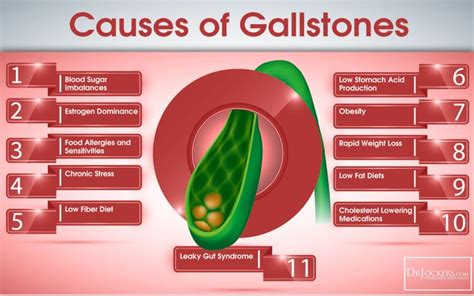 Gallbladder Stones Symptoms - Yahoo Image Search Results | Gallstones ...