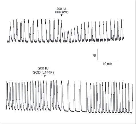 Characteristic trace of Ca 2+ induced uterine contractions monitoring ...