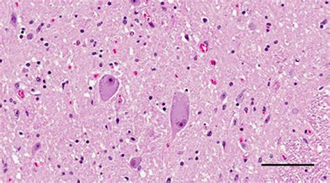 Medulla Spinalis Histology