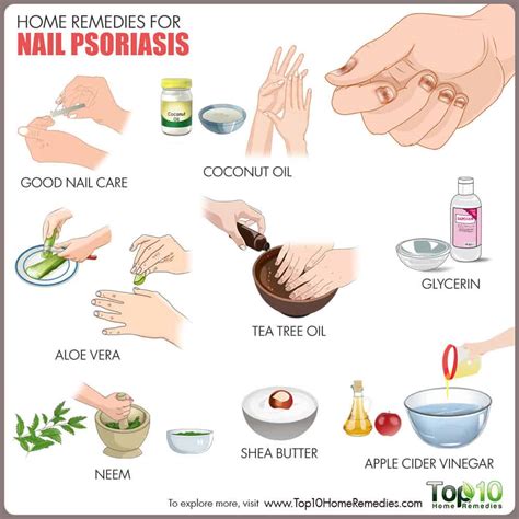 Home Remedies for Nail Psoriasis | Top 10 Home Remedies