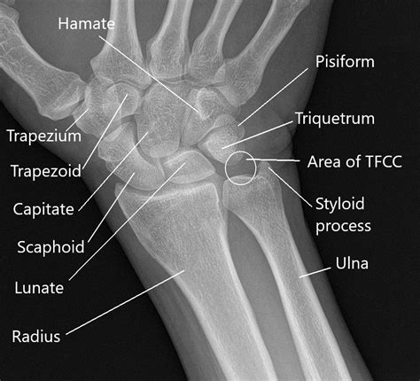 Anatomi Wrist Joint