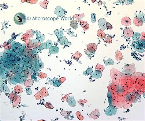 What Does Pap Smear Stand For – Telegraph