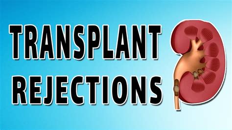 Kidney Transplants - YouTube