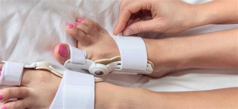 Bunions – causes, prevention, treatment. Bunion surgery – Healthy Food ...