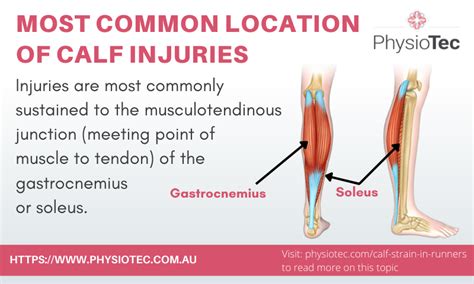 Calf Strain Recovery for Runners - PhysioTec