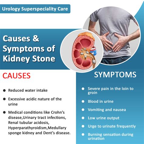 signs of kidney stones