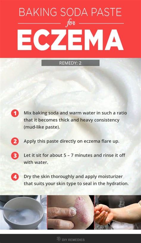 How to Soothe Eczema with Baking Soda