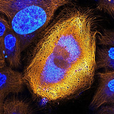 Stunning Microscopic View of Human Skin Cells Wins 2017 Nikon Small ...