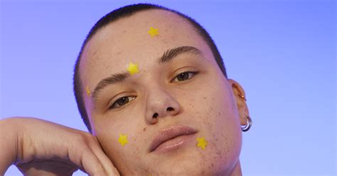 Pimple patches and zit stickers are everywhere. Do they work? - Vox