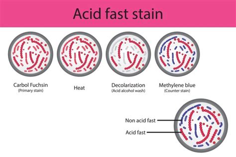 Principle and Procedure of Acid Fast Staining - Solution Parmacy