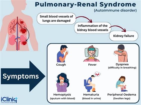 What Is a Pulmonary-Renal Syndrome?