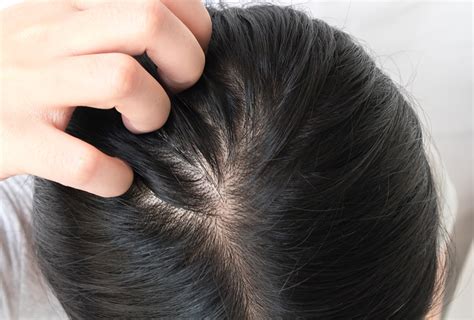 Itchy Scalp: Causes, Treatment, & When to See a Doctor