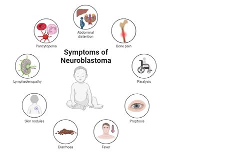 Overview of Neuroblastoma Symptoms. | BioRender Science Templates