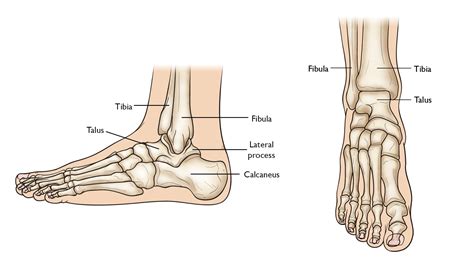 Talus Contusion