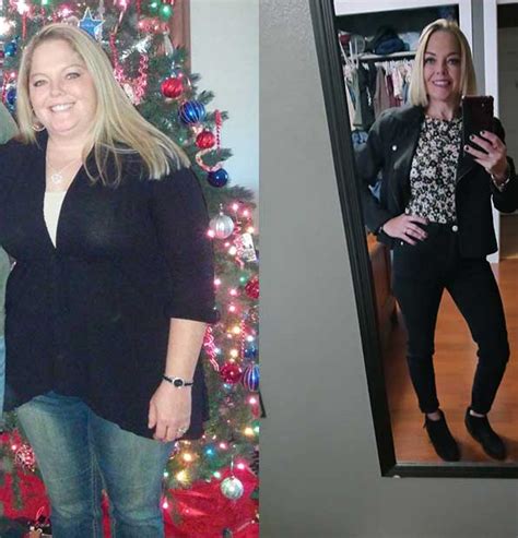 Gastric Sleeve Success Stories: Before & After Photos