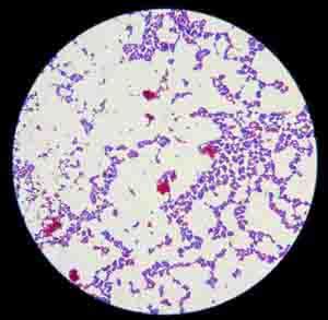 Acid Fast Stain Free Microbiology Images from Science Prof Online