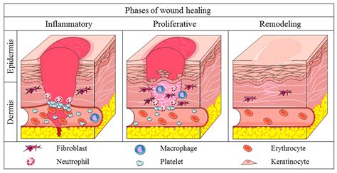 Wound Healing Diagram