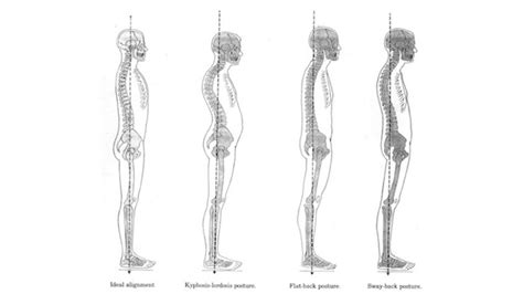 pilates | What happens when your body is out of alignment?