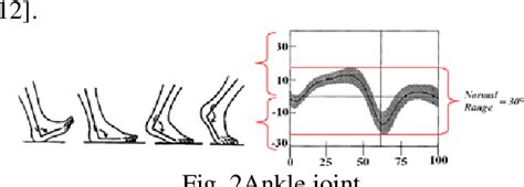 Figure 1 from Classification of hemiplegic gait using kinetic data on ...