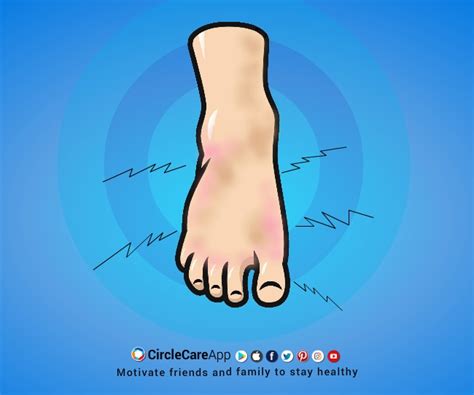 Symptom of Diabetes: Tingling hands and feet | CircleCare