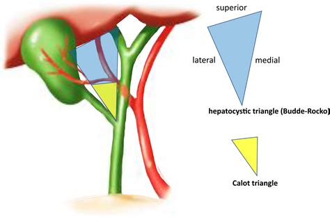 Gallstones | Biliary Colic | Cholecystitis | Geeky Medics