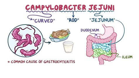 Campylobacter jejuni: Video, Anatomy & Definition | Osmosis