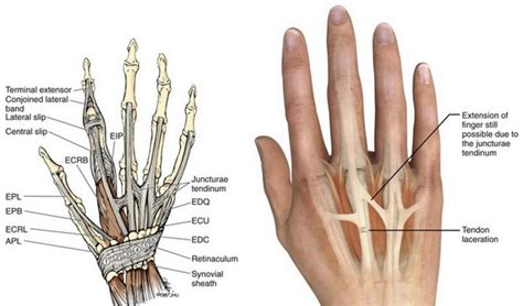 Left Hand Tendons Diagram | Online Wiring Diagram