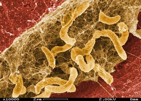 How To Manage Biofilm Formation And Control In Food Processing Facilities