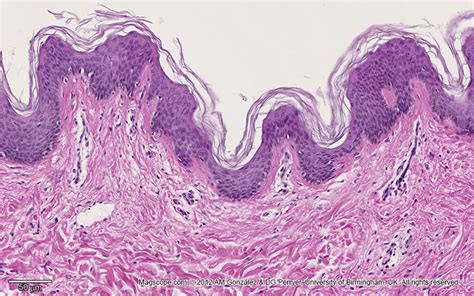 Stratified Squamous Epithelium Keratinized Skin