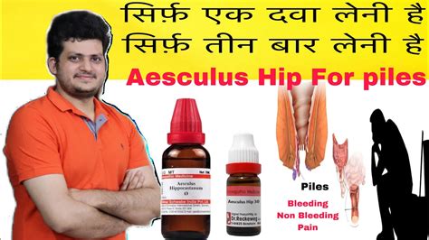 Aesculus Powerful Homeopathic Medicine for Piles | 100% effective ...