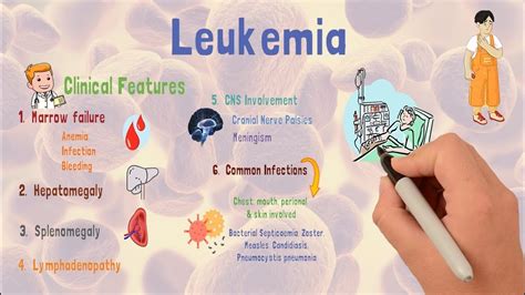 Leukemia | Causes | Types | Early signs & Treatment - YouTube