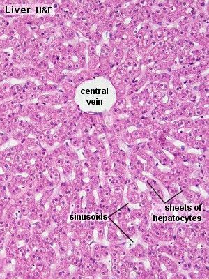 LIver histology Medical Laboratory Science, Science Biology, Medicine ...