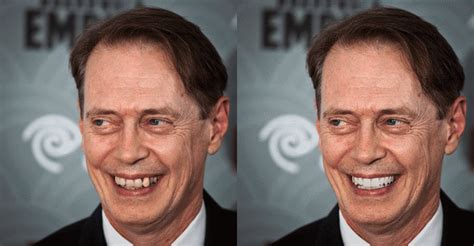 TIL Steve Buscemi adamantly refuses to have his famously misaligned ...