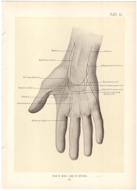 1899 Antique PALM OF HAND Surgical Anatomy by sushipotvintage