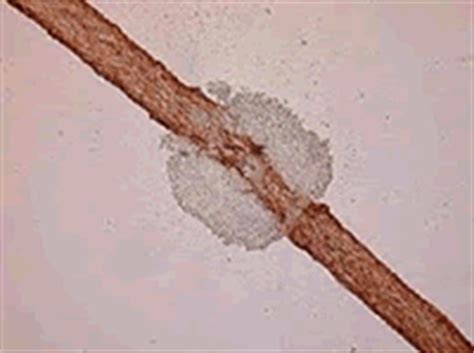 Trichosporon Fungus