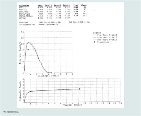 Normal Spirometry Results | Download Scientific Diagram