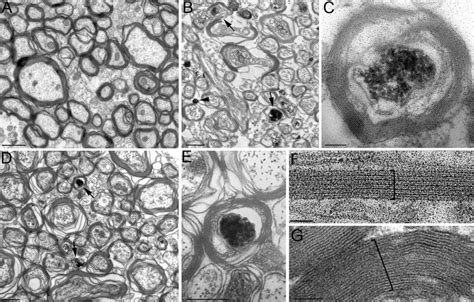 A) The electron microscope picture of sagittally cut sections from ...