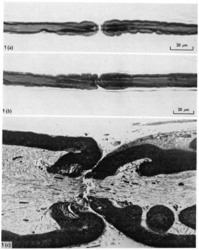 Tourniquet Safety: Mechanisms and Prevention of Injuries | Tourniquets.org