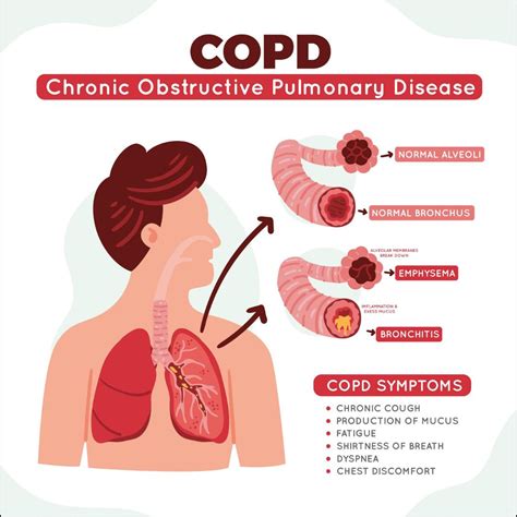 What are the common symptoms and risk factors for COPD?