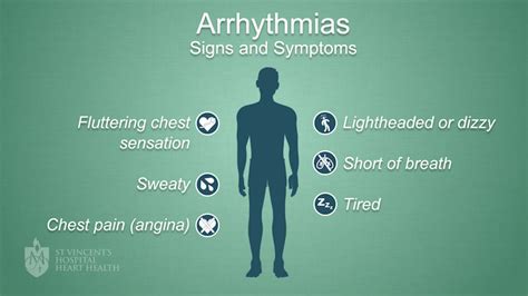 How To Prevent Arrhythmia - Economicsprogress5