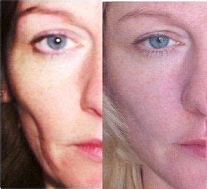 makeup for sagging jowls - Google Search | Natural face lift, Facial ...