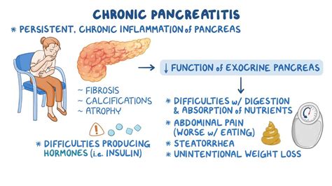 Chronic pancreatitis: Clinical sciences - Osmosis Video Library